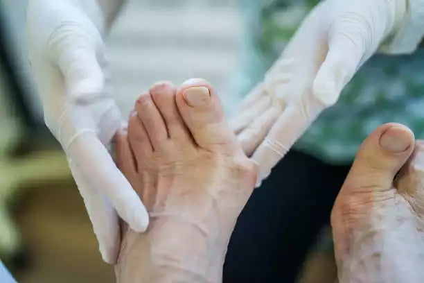 Chirurgien regardant un hallux valgus avant son opération