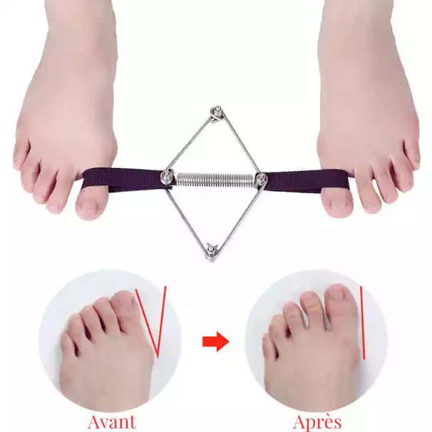effet avant-après grâce à l'utilisation de l'élastique