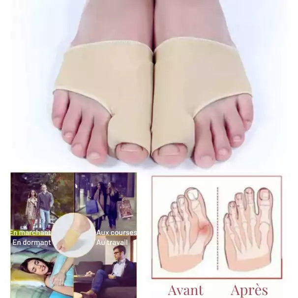 Mise en situation possible de l'orthèse